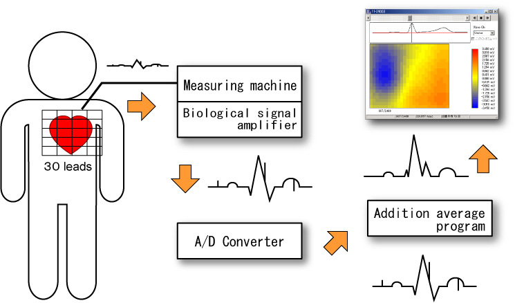 心電図の時間周波数解析支援システム